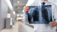 A stock image shows a person dressed as a doctor holding a chest x-ray